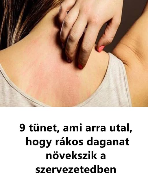 9 Tunet Ami Arra Utal Hogy Rakos Daganat Nove